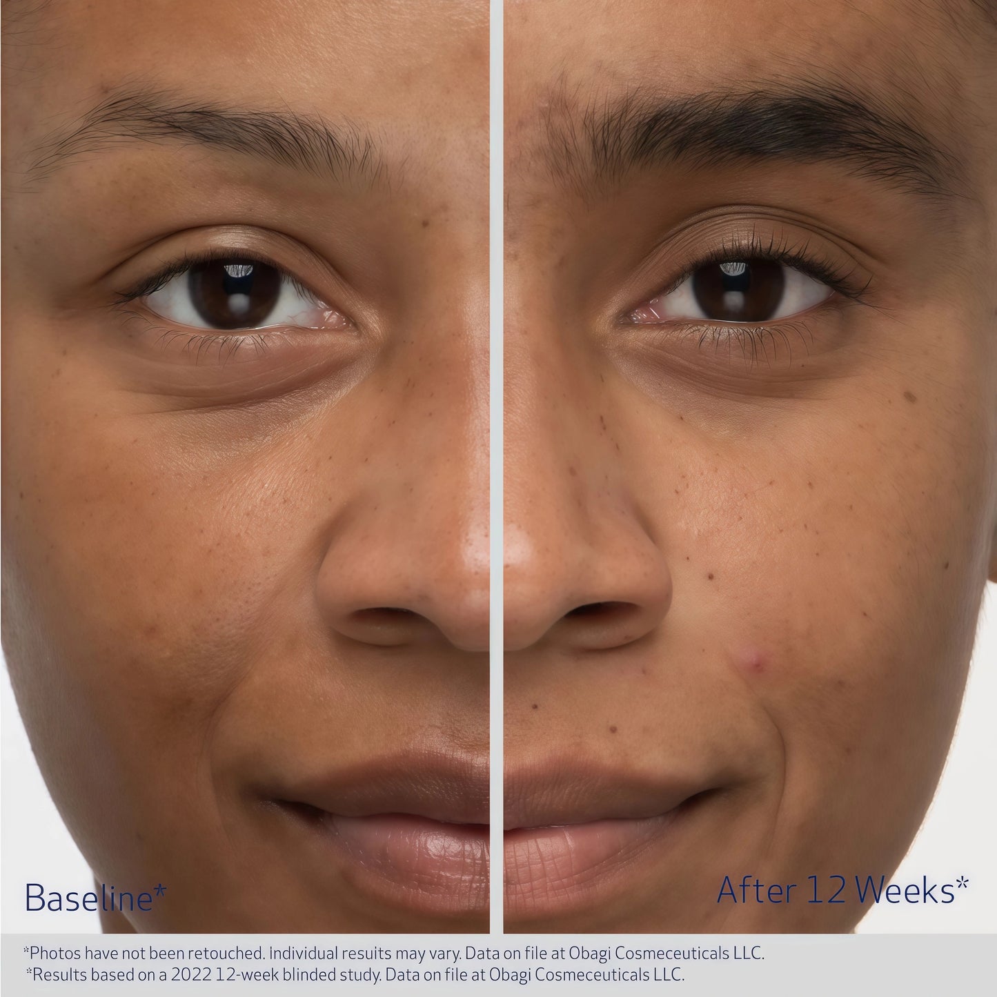 EYEBROW BOOSTING SERUM 1 Pack (3-Month supply)