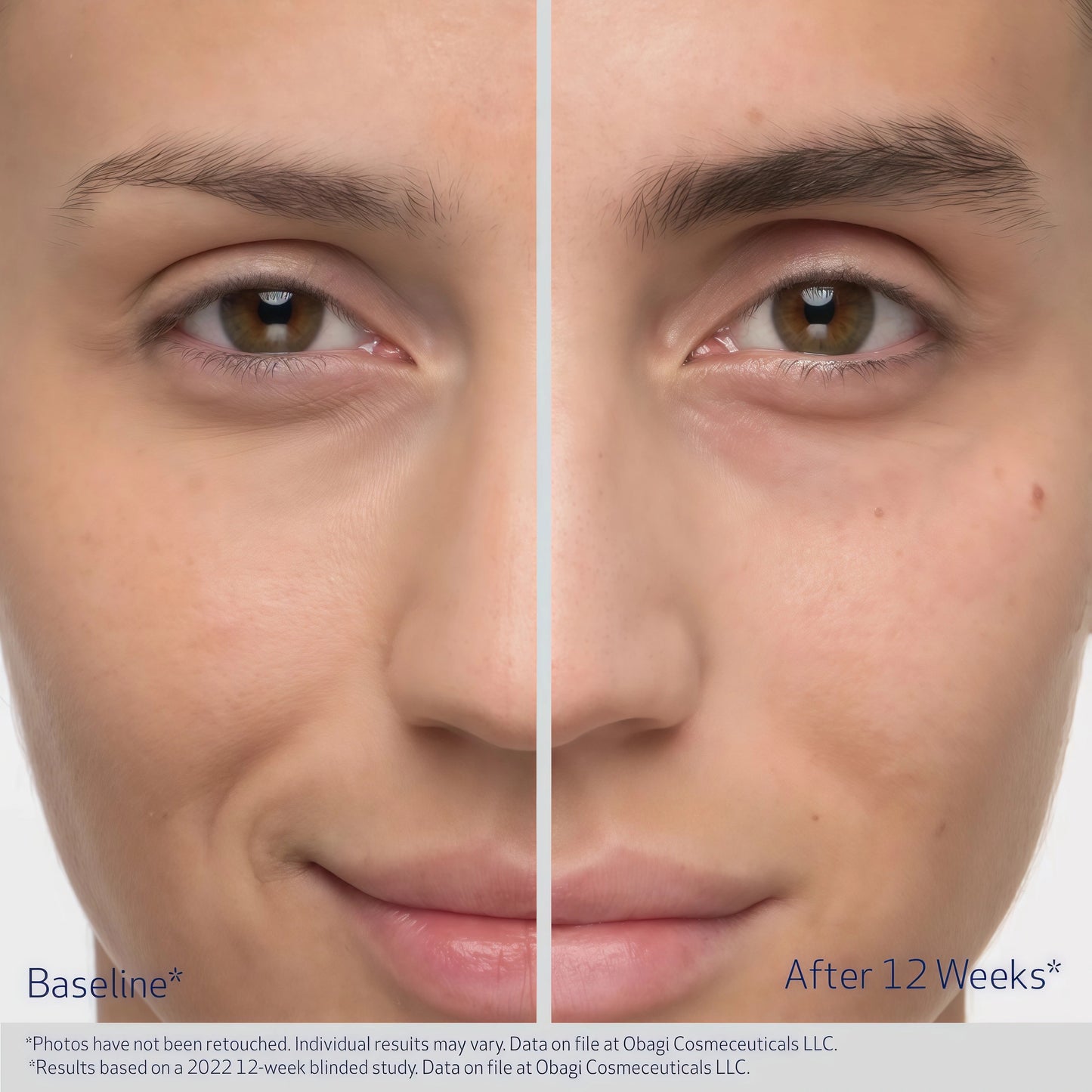 EYEBROW BOOSTING SERUM 1 Pack (3-Month supply)