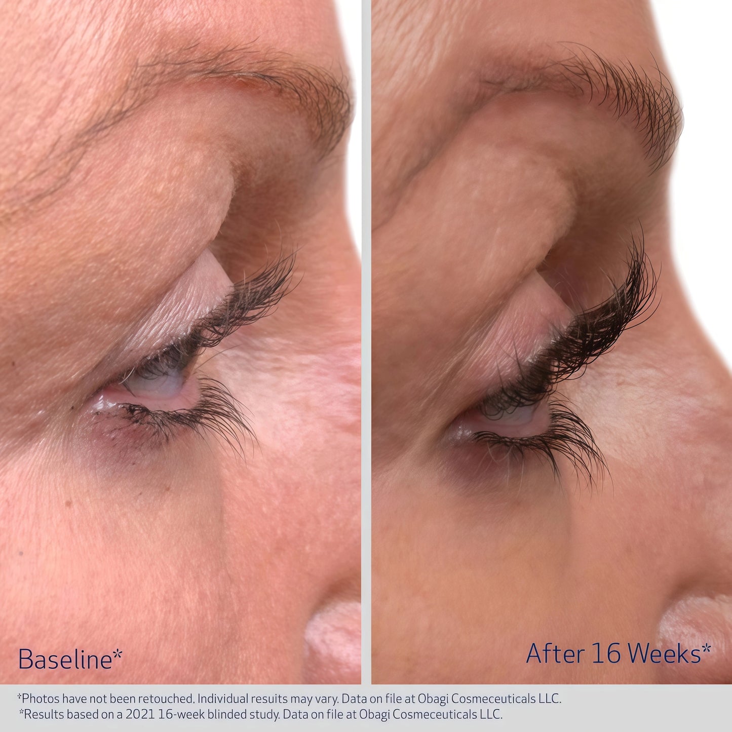 EYELASH ENHANCING SERUM 1 Pack (3-Month supply)