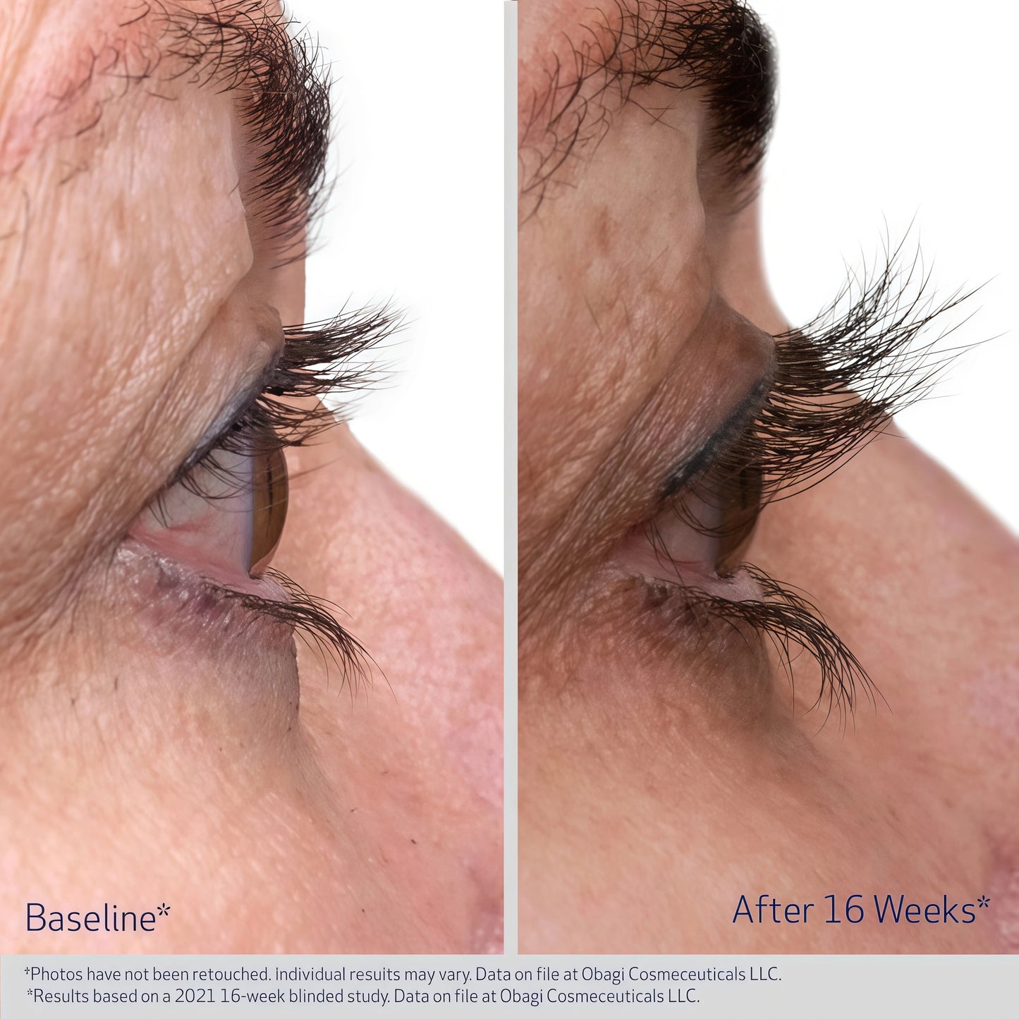 EYELASH ENHANCING SERUM 1 Pack (3-Month supply)